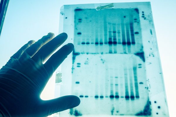 DNA genetic analysis results