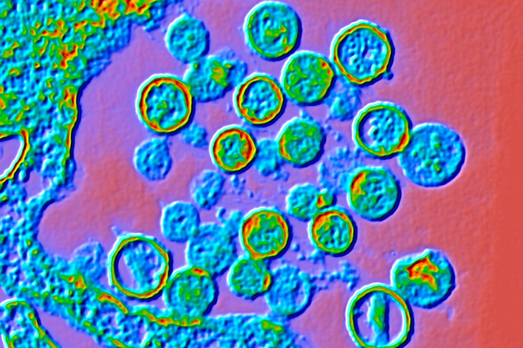 Hantavirus particles