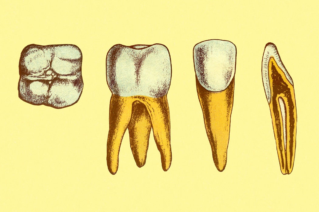 Four teeth on a yellow background