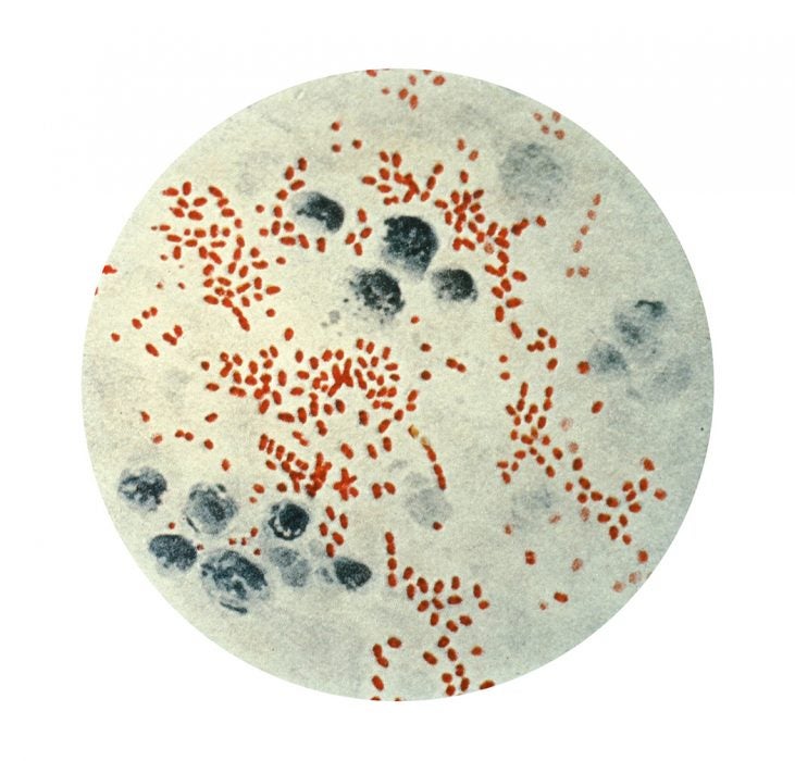 Pasturella pestis