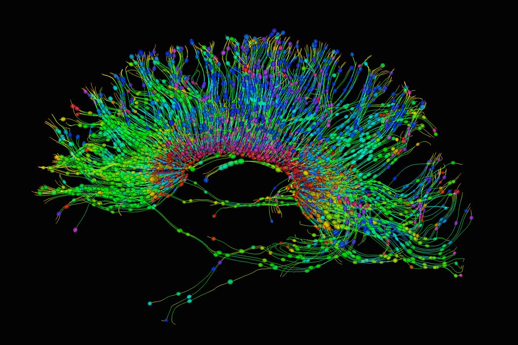 A Diffusion MRI, also referred to as diffusion tensor imaging or DTI, of the human brain