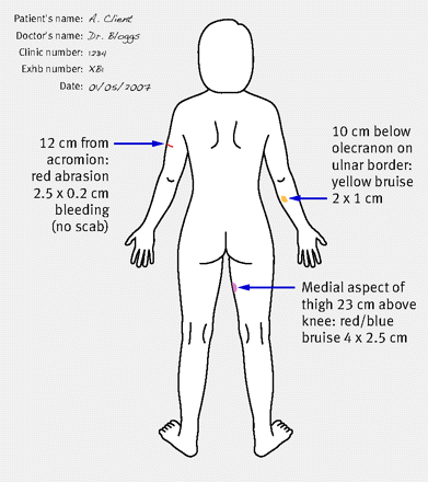 Figure1