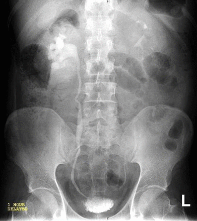 Figure2