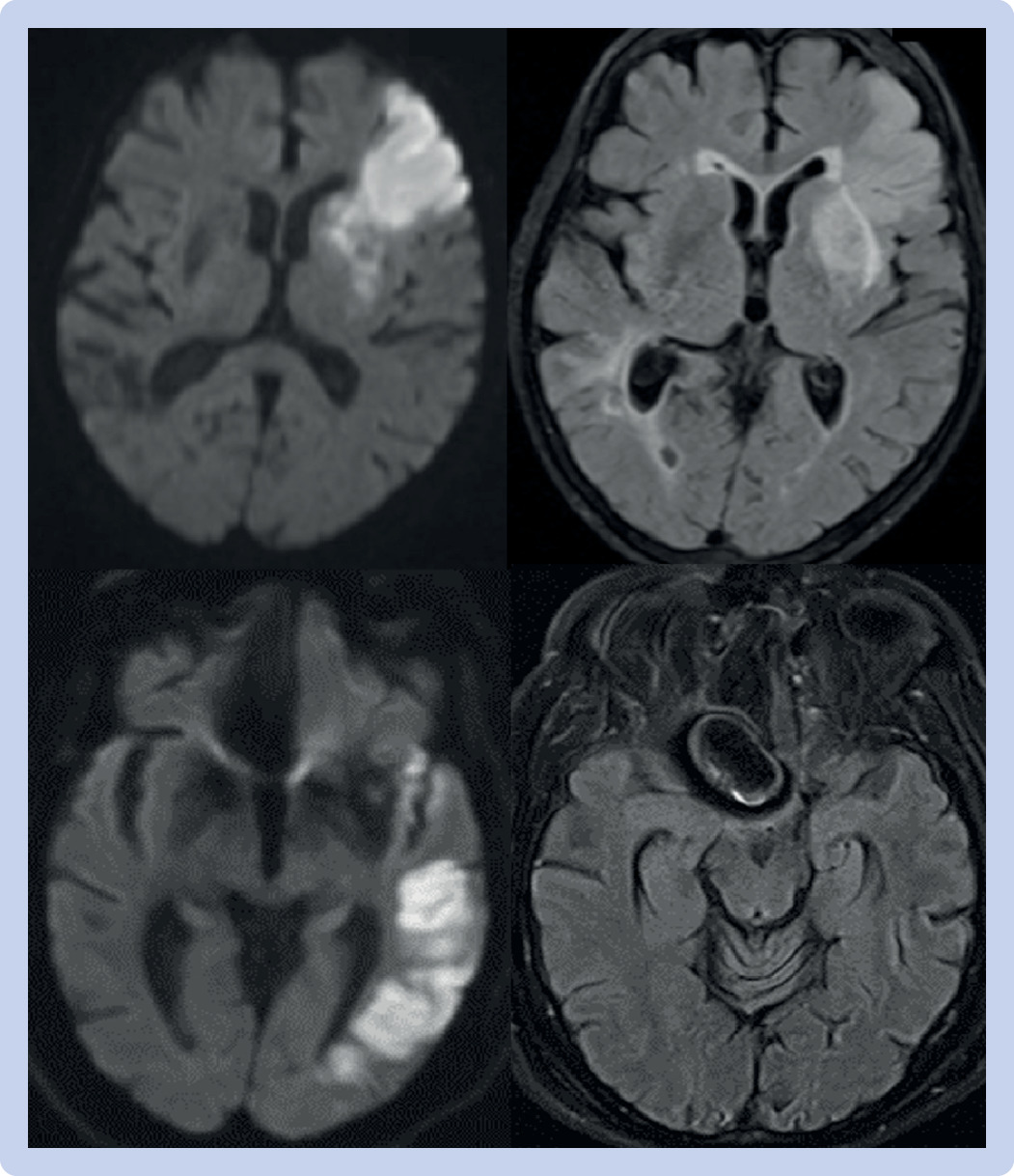Fig 3