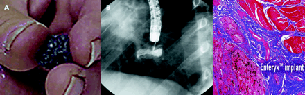   Figure 4 