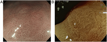 Figure 9