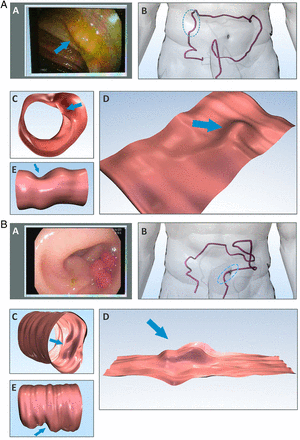 Figure 2