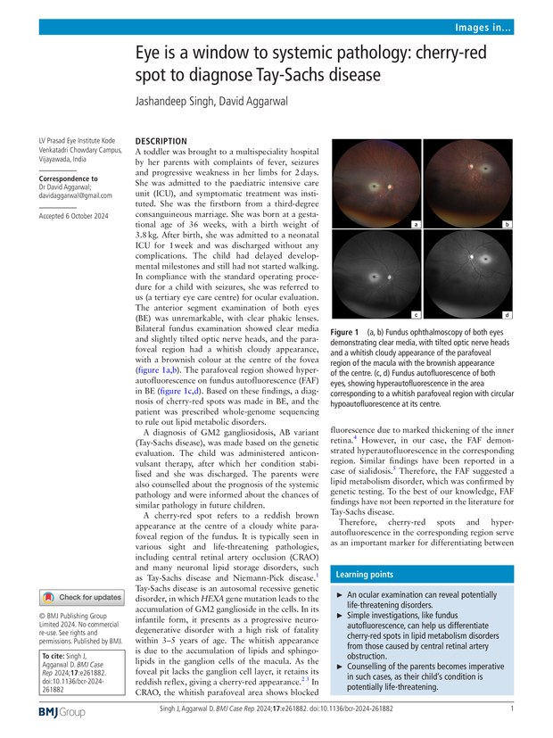 PDF extract preview