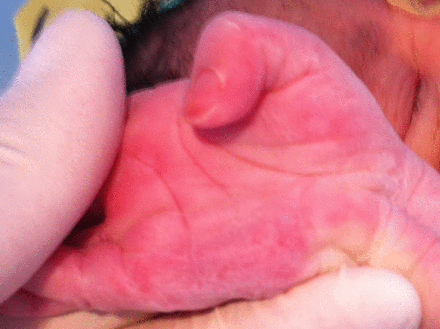 Figure 2