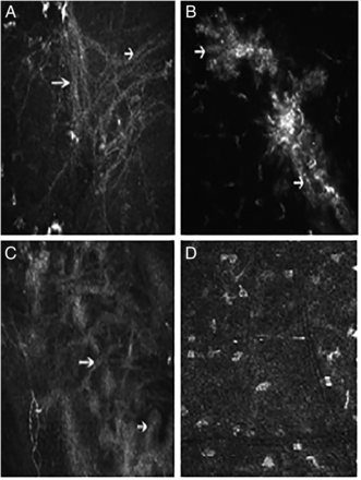 Figure 20