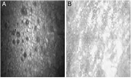 Figure 30