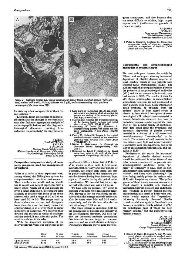 PDF extract preview