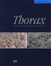 Thorax: 53 (8)