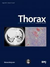 Thorax: 76 (8)