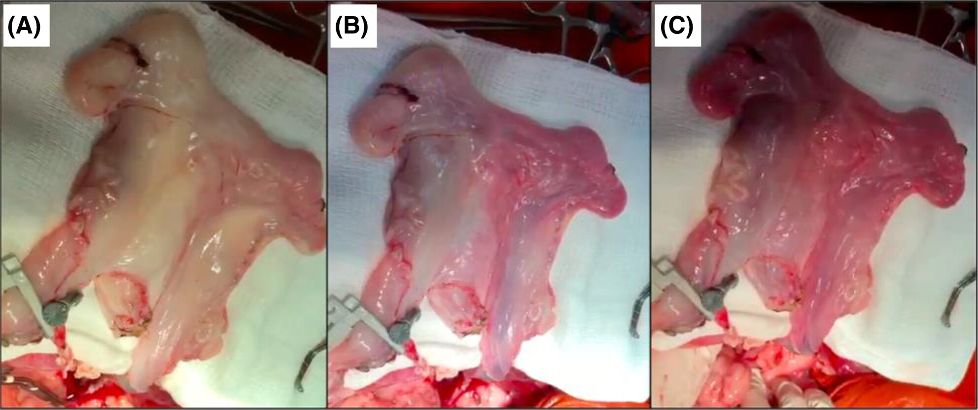 Analysis of two reperfusion techniques in uterine transplantation in an experimental model