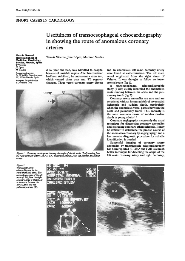 PDF extract preview