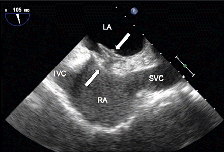 Figure 14
