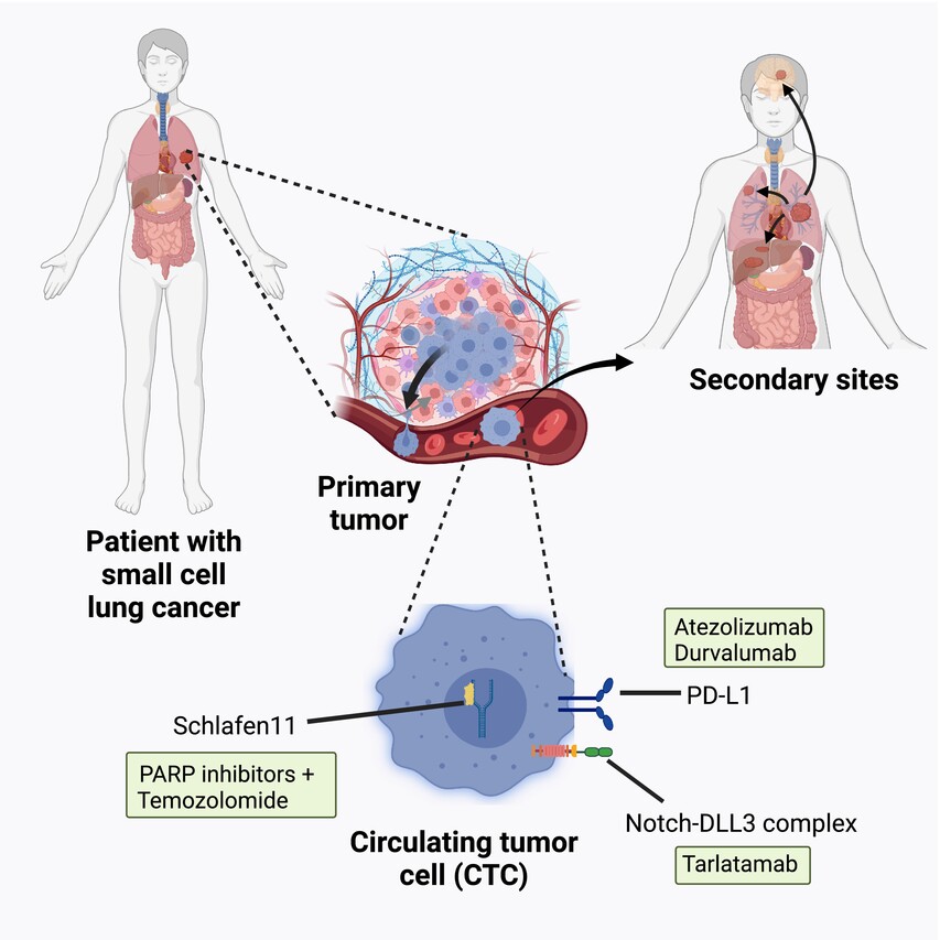 Circulating tumor cells: advancing personalized therapy in small cell lung cancer patients