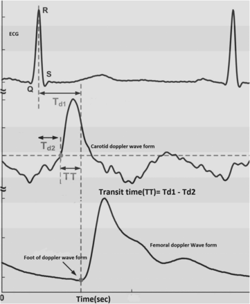 Figure 1