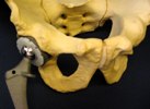 Hip joint